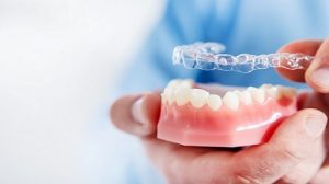 Invisible,And,Removable,Aligners,For,Teeth,Alignment